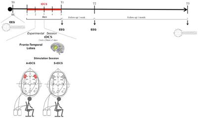 Behavioral and Neurophysiological Effects of Transcranial Direct Current Stimulation (tDCS) in Fronto-Temporal Dementia